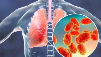 What is pneumonia and how is it treated?