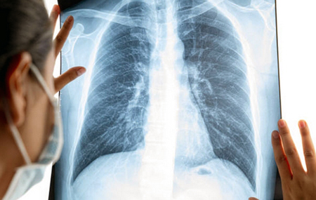 tests for bronchitis