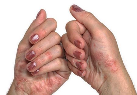 skin diseases causes