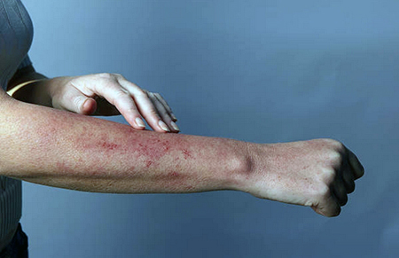 skin rash causes