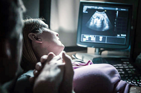 diagnosis of gestational choriocarcinoma