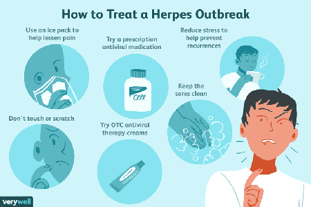 how is herpes treated