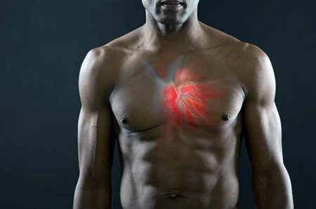 causes of heart pain