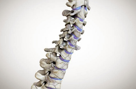 spine diseases