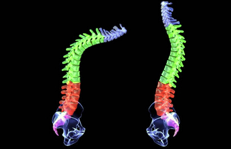 degenerative spine diseases symptoms and treatment