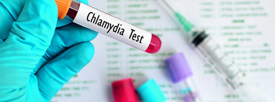 Chlamydia