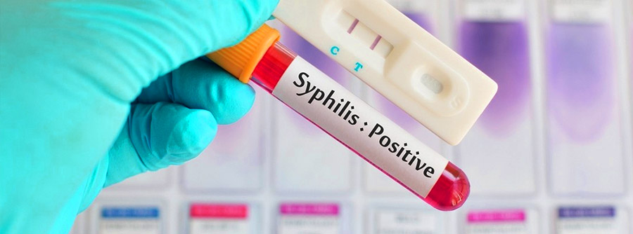 Syphilis-positive