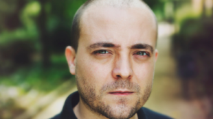 Frequently asked questions about Finasteride Frequently asked questions about Finasteride