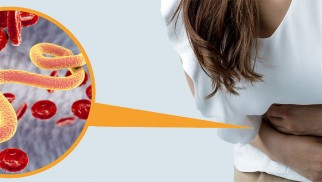 Understanding Giardiasis: Causes, Symptoms, Prevention, and Treatment