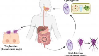 Understanding Giardiasis: Causes, Symptoms, Prevention, and Treatment