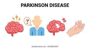 Understanding Parkinson’s Disease: A Comprehensive Guide Understanding Parkinson’s Disease: A Comprehensive Guide