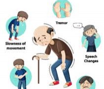 Understanding Parkinson’s Disease: A Comprehensive Guide Understanding Parkinson’s Disease: A Comprehensive Guide