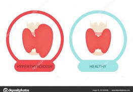Understanding Hypothyroidism of Different Etiologies: Causes, Symptoms, and Treatment Understanding Hypothyroidism of Different Etiologies: Causes, Symptoms, and Treatment