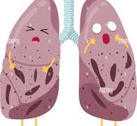 Understanding and Managing Tuberculosis: A Complete Guide