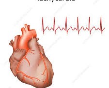 Tachycardia: Understanding and Managing a Rapid Heartbeat Tachycardia: Understanding and Managing a Rapid Heartbeat