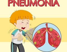 Pneumonia Explained: Understanding, Preventing, and Treating Lung Infections
