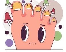 Understanding and Treating Fungal Infections Safely and Completely