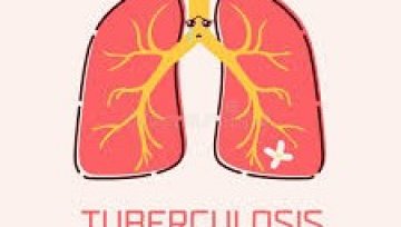 Understanding and Treating Tuberculosis Effectively