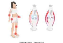 Understanding Inflammatory and Degenerative Diseases Understanding Inflammatory and Degenerative Diseases