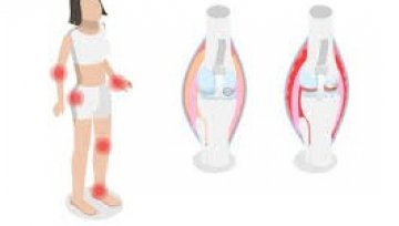Understanding Inflammatory and Degenerative Diseases