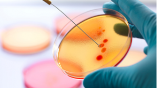 Order Cipro online to save on the treatment wisely Order Cipro online to save on the treatment wisely