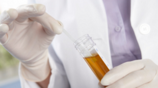 Generic Macrobid – frequently asked questions Generic Macrobid – frequently asked questions