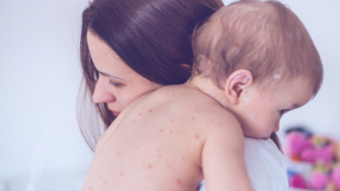 Buy Valacyclovir online to treat herpes quickly Buy Valacyclovir online to treat herpes quickly