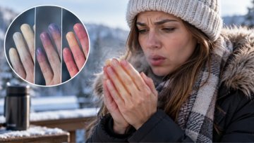 Raynaud Phenomenon: Why Fingers Turn White, When It Signals Something More and What Helps