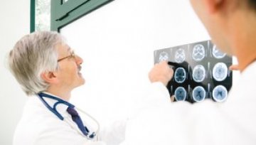 Generic Modalert helps to treat Alzheimers disease
