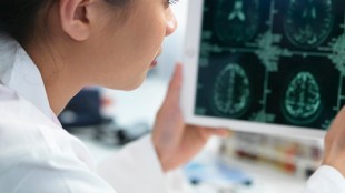 Generic Modalert helps to struggle with Dementia Generic Modalert helps to struggle with Dementia