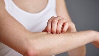 What can you do if you have itchy skin?