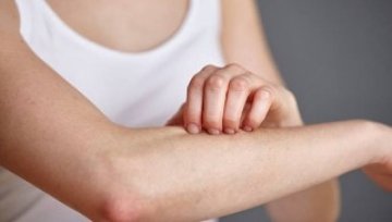 What can you do if you have itchy skin?