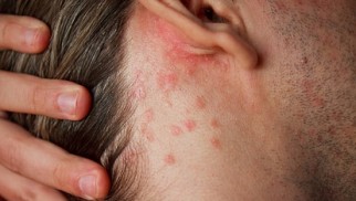 What can you do if you have itchy skin?