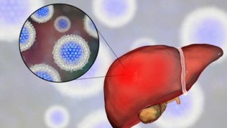 Is the effective treatment of Hepatitis C is attainable to everyone? Is the effective treatment of Hepatitis C is attainable to everyone?