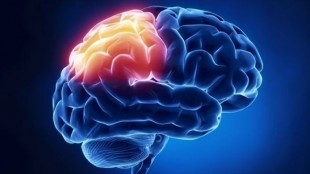 Increase your brain capacity with Generic Modalert 200 mg