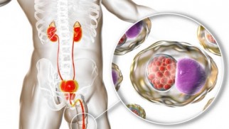 What is urethritis and how is it treated? What is urethritis and how is it treated?