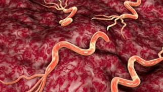 What is stomach ulcer and how is it treated? What is stomach ulcer and how is it treated?