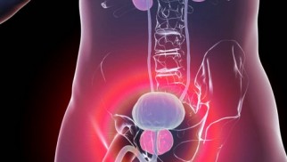 What you need to know about benign prostatic hyperplasia treatment What you need to know about benign prostatic hyperplasia treatment