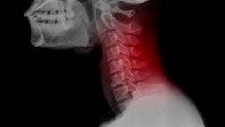 What are degenerative diseases of the spine and how are they treated?