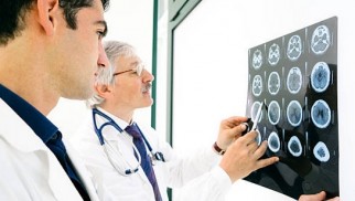What is a stroke and how is it treated?