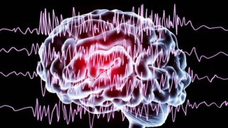 Seizures of central origin  what are they and how are they treated?