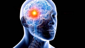 What are brain tumors and how are they treated? What are brain tumors and how are they treated?