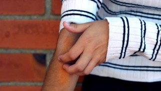 Skin diseases – symptoms, types, treatments Skin diseases – symptoms, types, treatments
