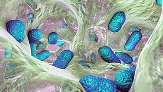 Urinary tract infections – symptoms, risks, treatment Urinary tract infections – symptoms, risks, treatment