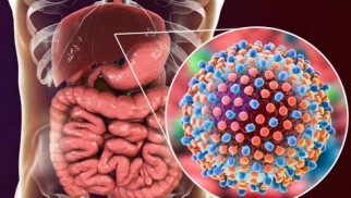 Viral hepatitis C: risk factors, symptoms, and treatment methods Viral hepatitis C: risk factors, symptoms, and treatment methods
