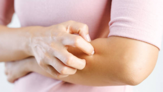 Drug allergy: what you need to know Drug allergy: what you need to know
